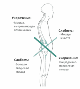 Лечение мышечной слабости (гипотонуса) в Ровно