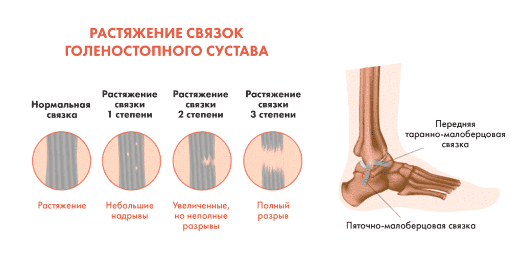 Лечение ушибов в Ровно